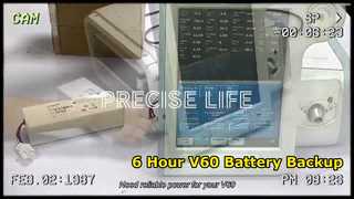 Respironics V60 人工呼吸器バッテリー 6 時間の稼働時間